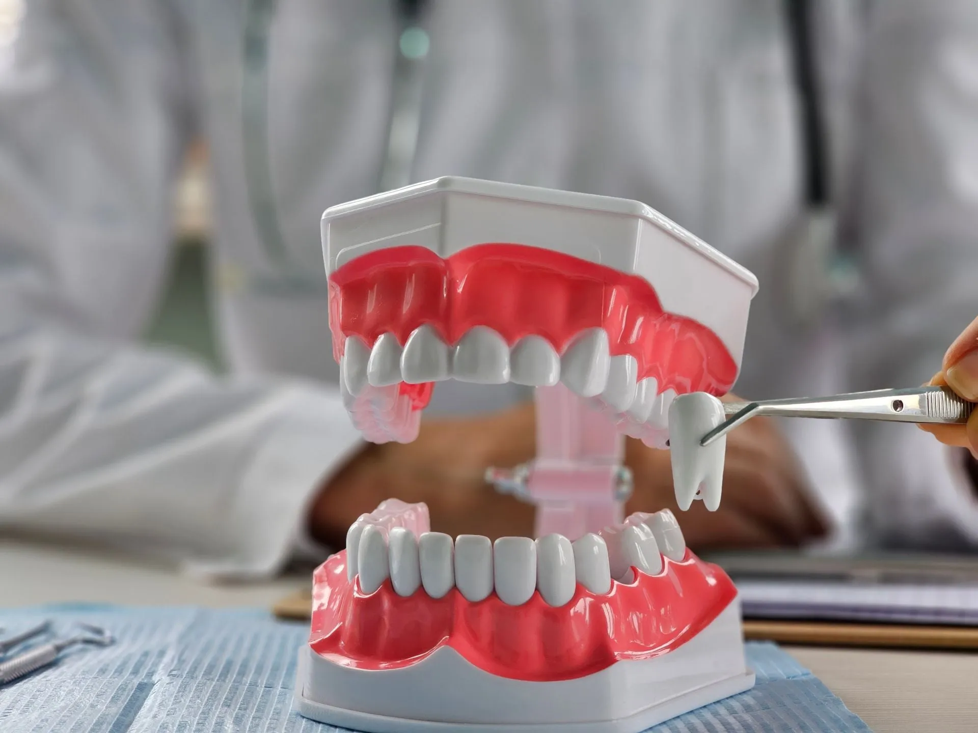 Wisdom Teeth Extraction — our approach