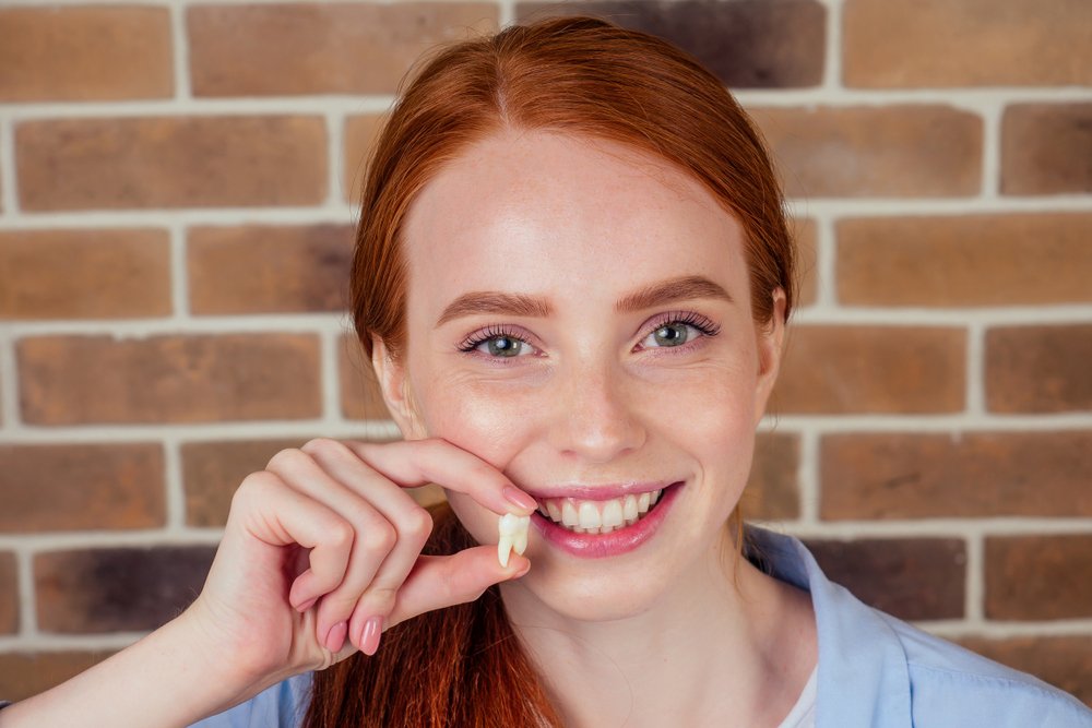 Wisdom Teeth Extraction — what to know