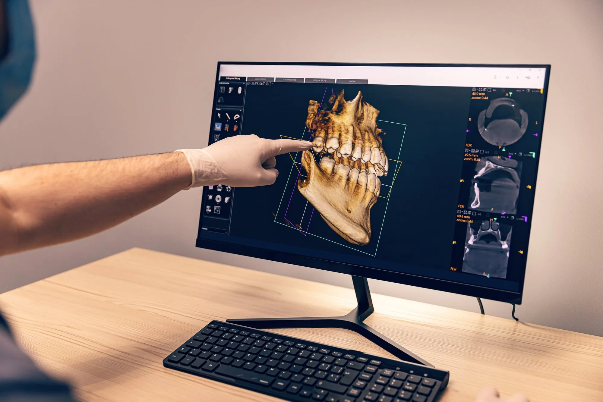 Bone Grafting — our approach