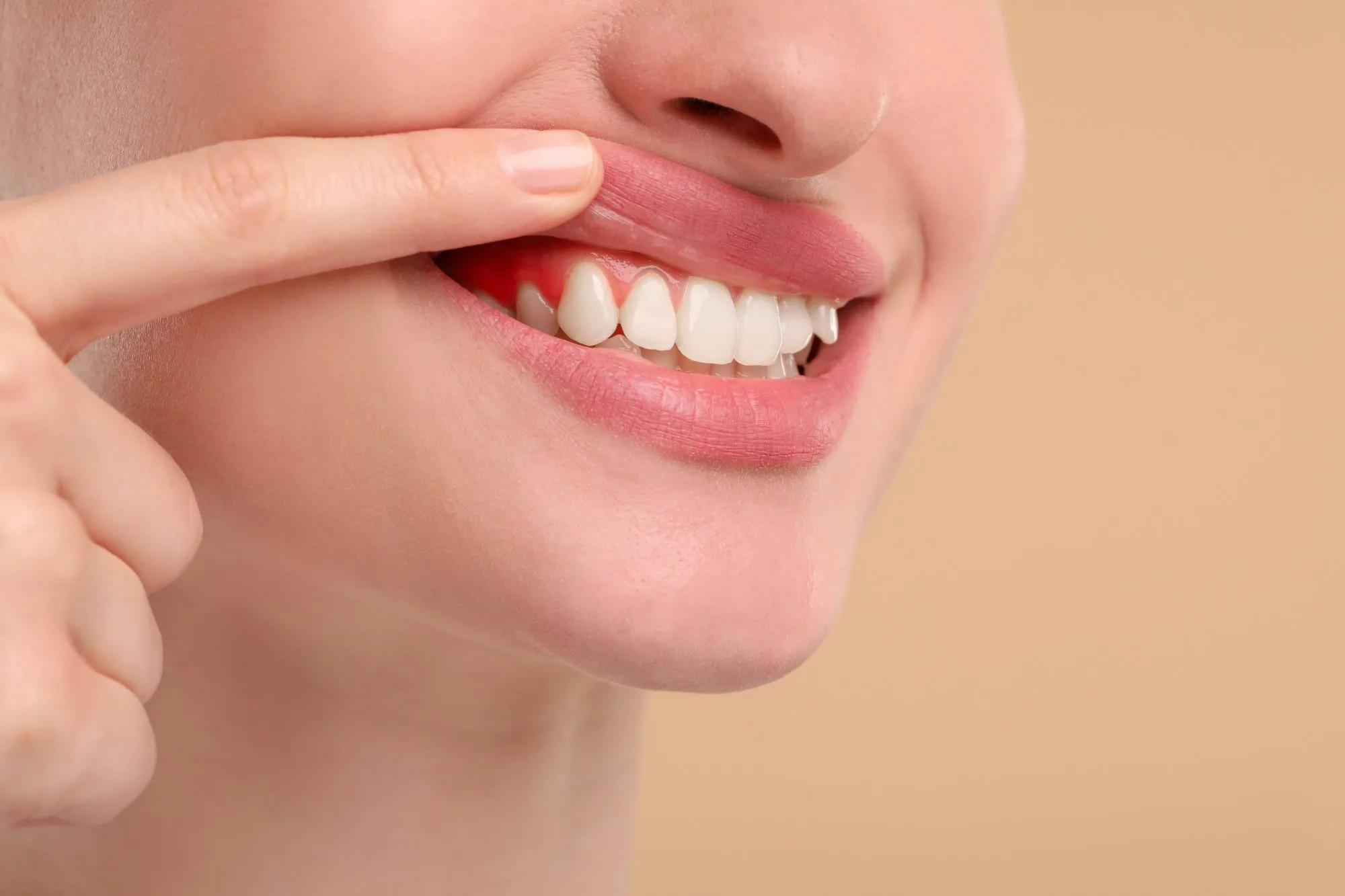 Botox — what to know