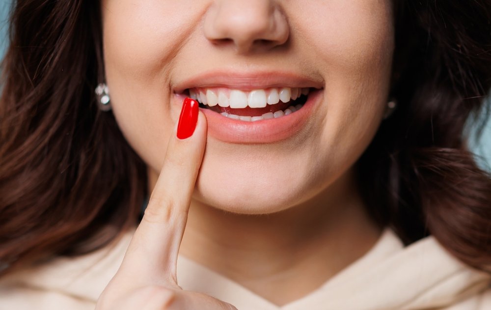 Gum Grafting — what to know