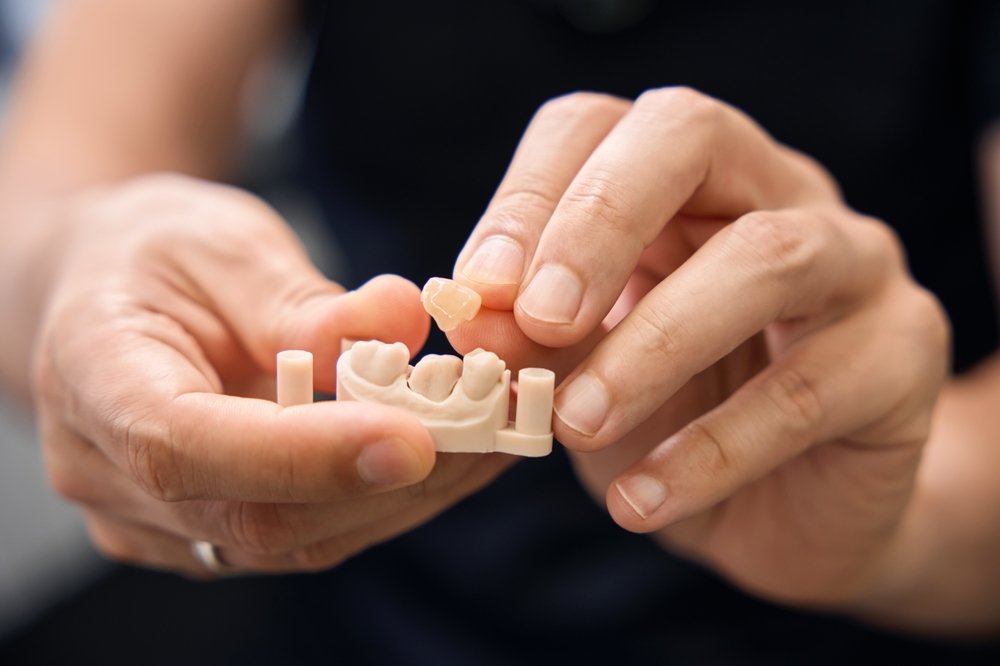 Same-Day CEREC Crowns — what to know
